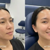 04_benefit_versatile_treatment