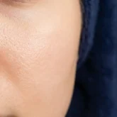 05_benefit_pore_refinement