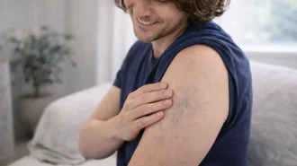 Laser tattoo removal 10